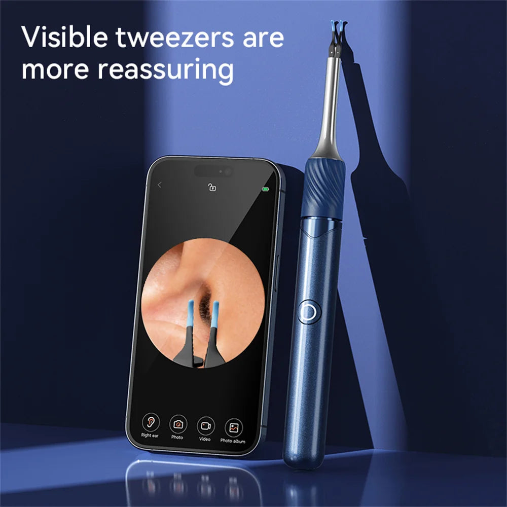 Limpiador Visual De Oídos Con Cámara, Herramienta De Eliminación De Cera De Oídos Con Recogedor Y Pinzas, 12 Megapíxeles, 6 Cucharas Para Los Oídos, Eliminación De Cera De Los Oídos, Cuidado De Los Oídos