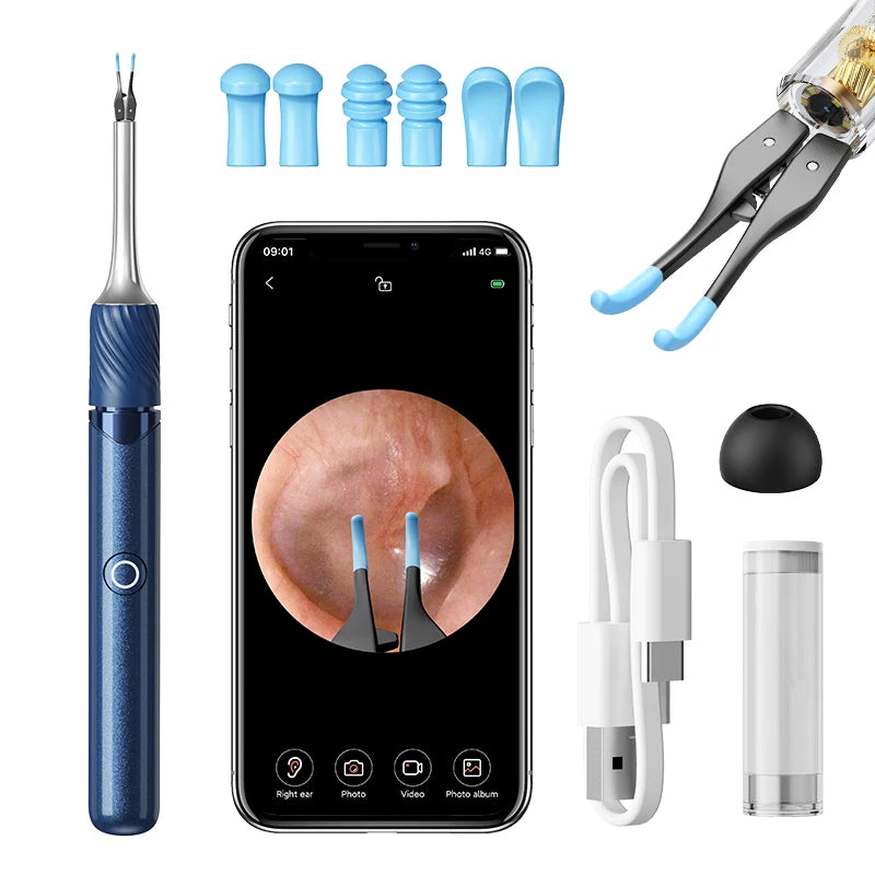 Limpiador Visual De Oídos Con Cámara, Herramienta De Eliminación De Cera De Oídos Con Recogedor Y Pinzas, 12 Megapíxeles, 6 Cucharas Para Los Oídos, Eliminación De Cera De Los Oídos, Cuidado De Los Oídos